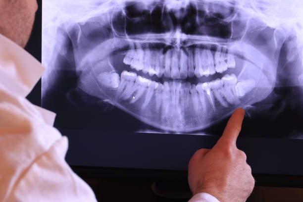Best Emergency Treatment for Toothache in Calera, OK