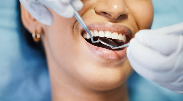 Best Emergency Tooth Extraction in Calera, OK