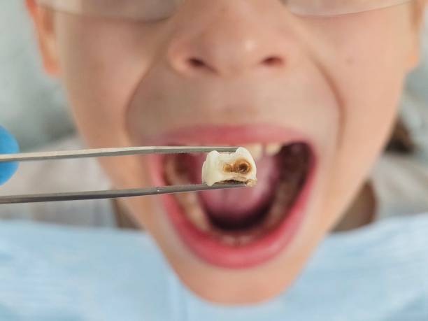Best Walk-In Emergency Dentist in Calera, OK